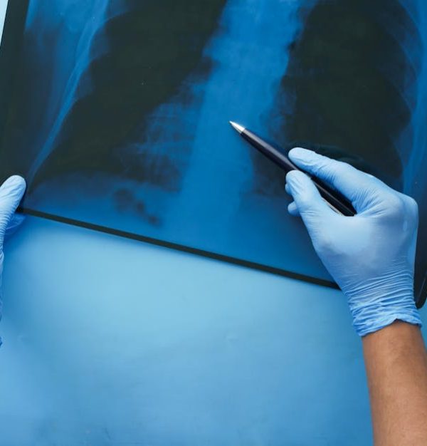 A doctor in blue gloves examines a chest x-ray with a pen, focusing on medical diagnosis.